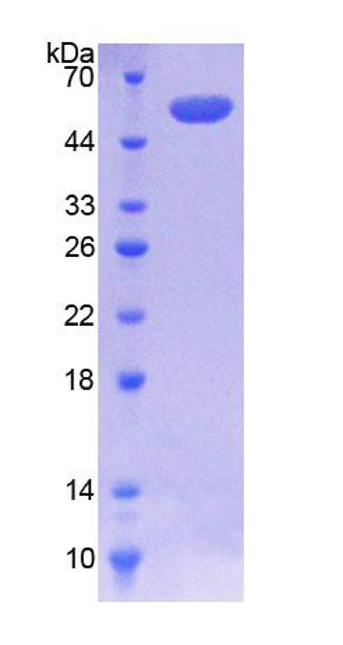 Human Recombinant Coenzyme Q6 Homolog, Monooxygenase (COQ6)