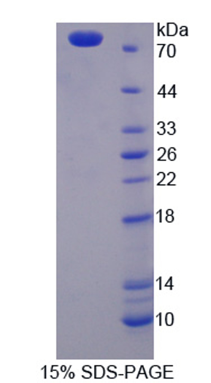 Mouse Recombinant Keratin 28 (KRT28)