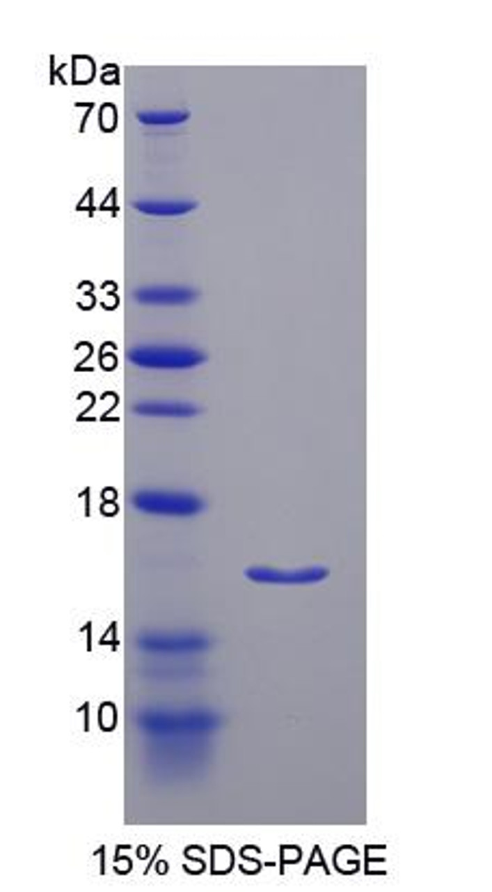 Rat Recombinant Insulin Receptor Substrate 3 (IRS3)