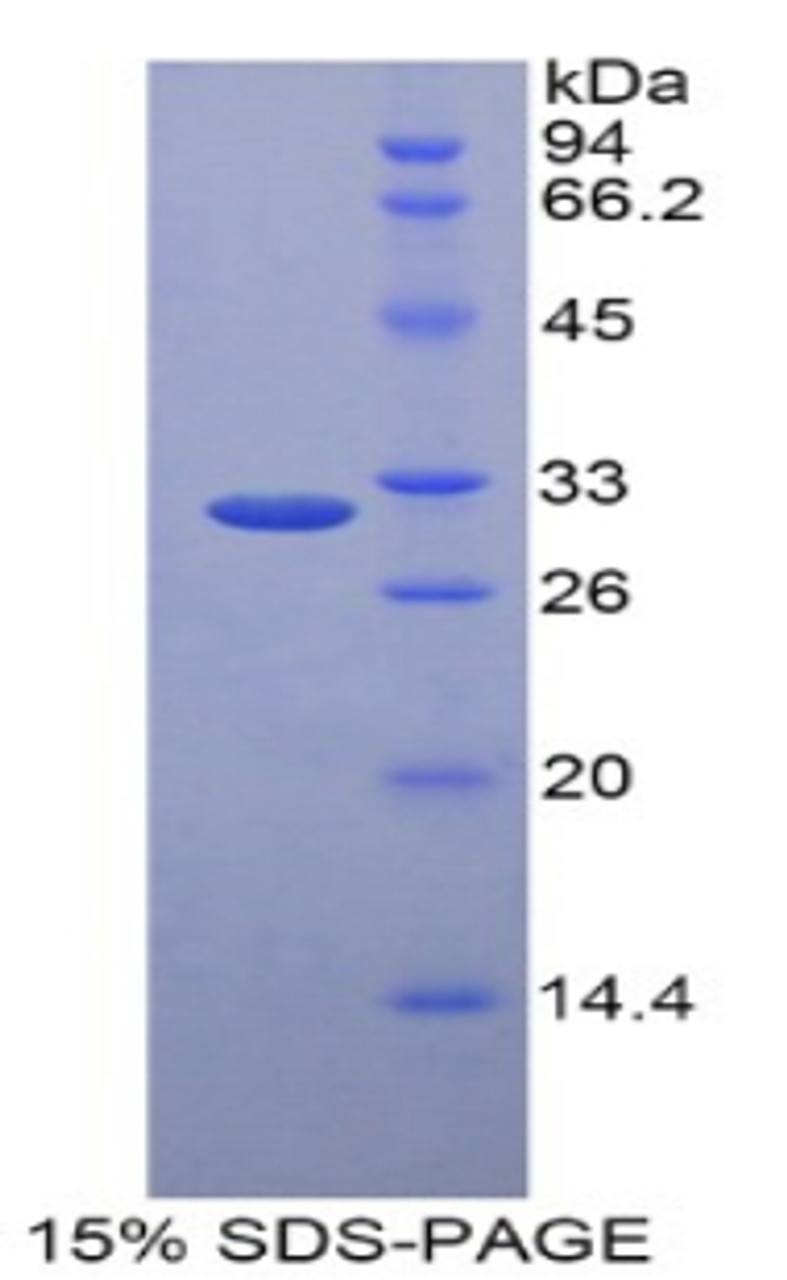 Human Recombinant Low Density Lipoprotein Receptor Related Protein 5 Like Protein (LRP5L)