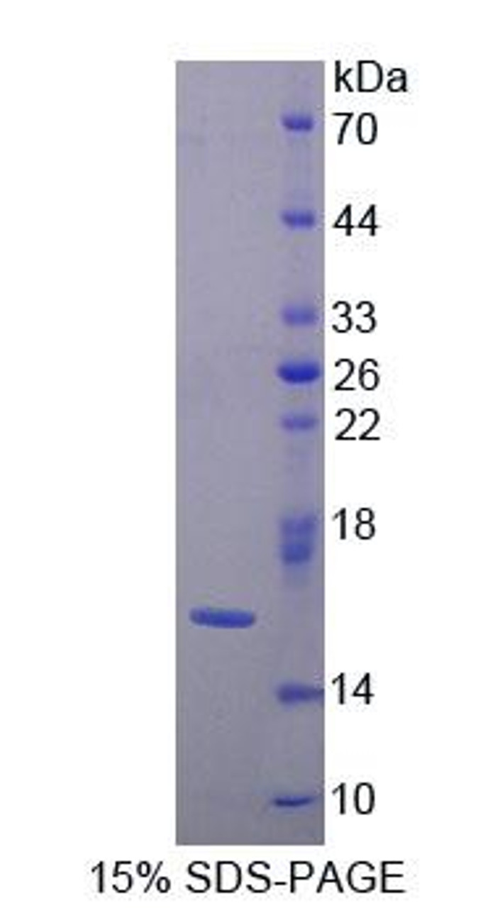 Human Recombinant Galectin 9B (GAL9B)