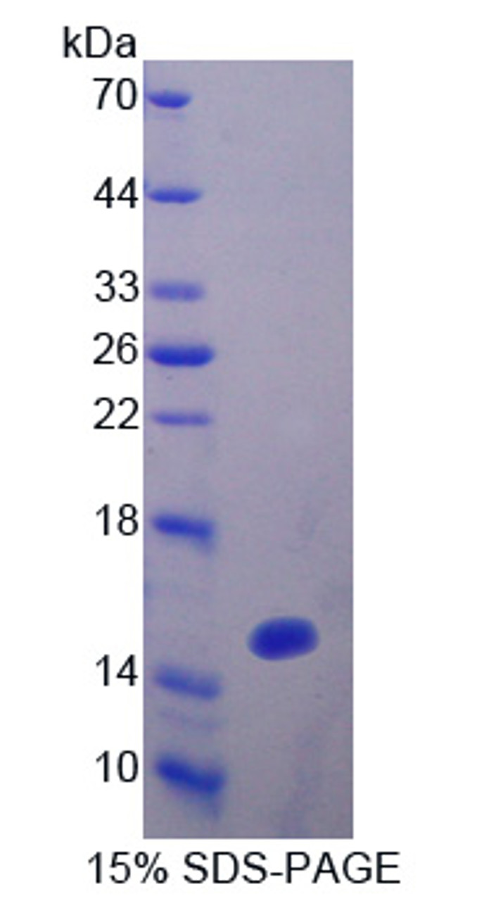 Human Recombinant Occludin/ELL Domain Containing Protein 1 (OCEL1)