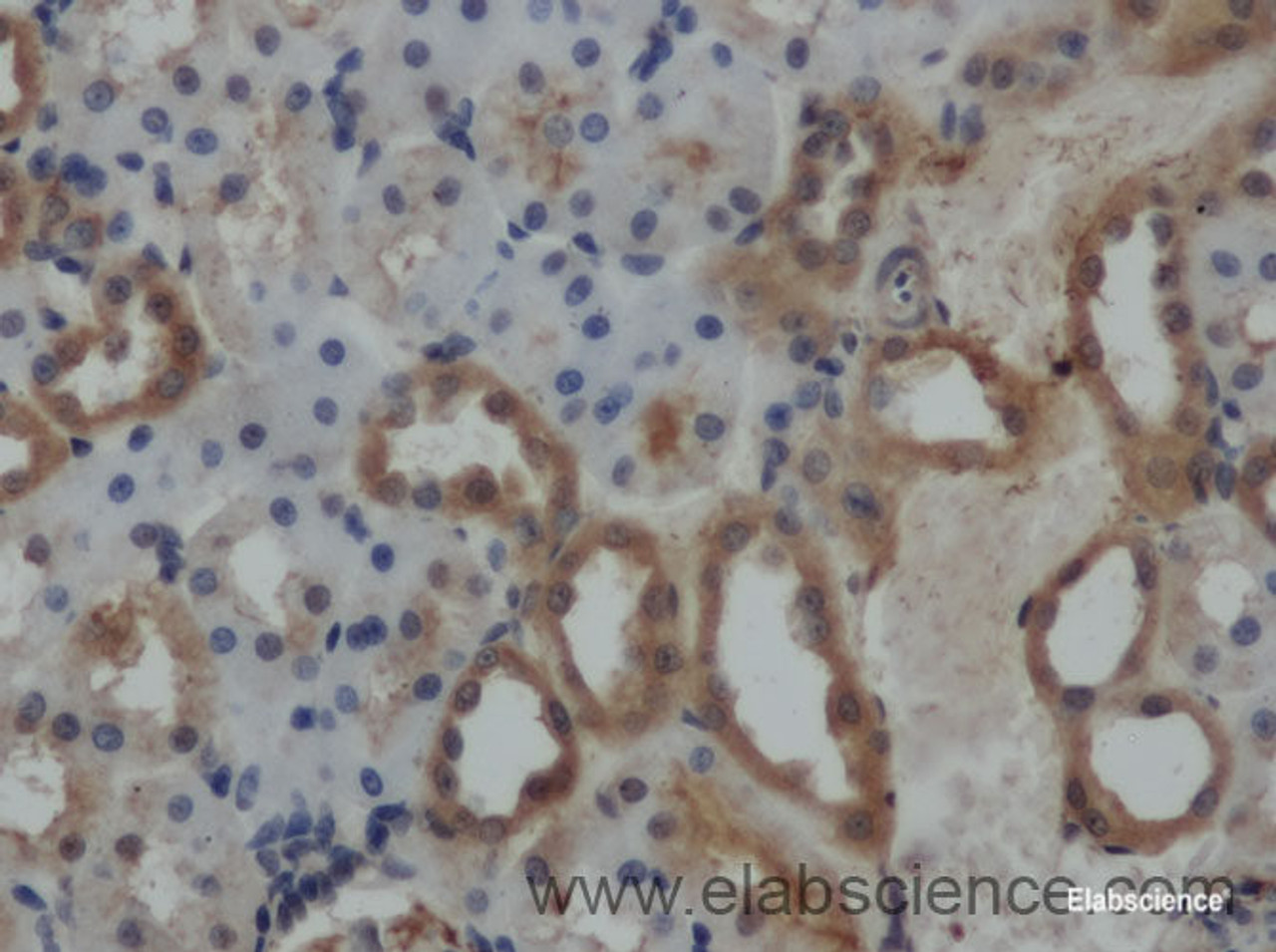 Immunohistochemistry of paraffin-embedded Rat kidney using VEGFA Polyclonal Antibody at dilution of 1:50