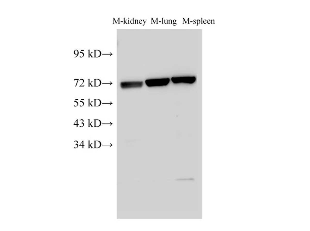 Western Blot analysis of Mouse kidney, Mouse lung and Mouse spleen using Lamin B1 Polyclonal Antibody at dilution of 1:1000