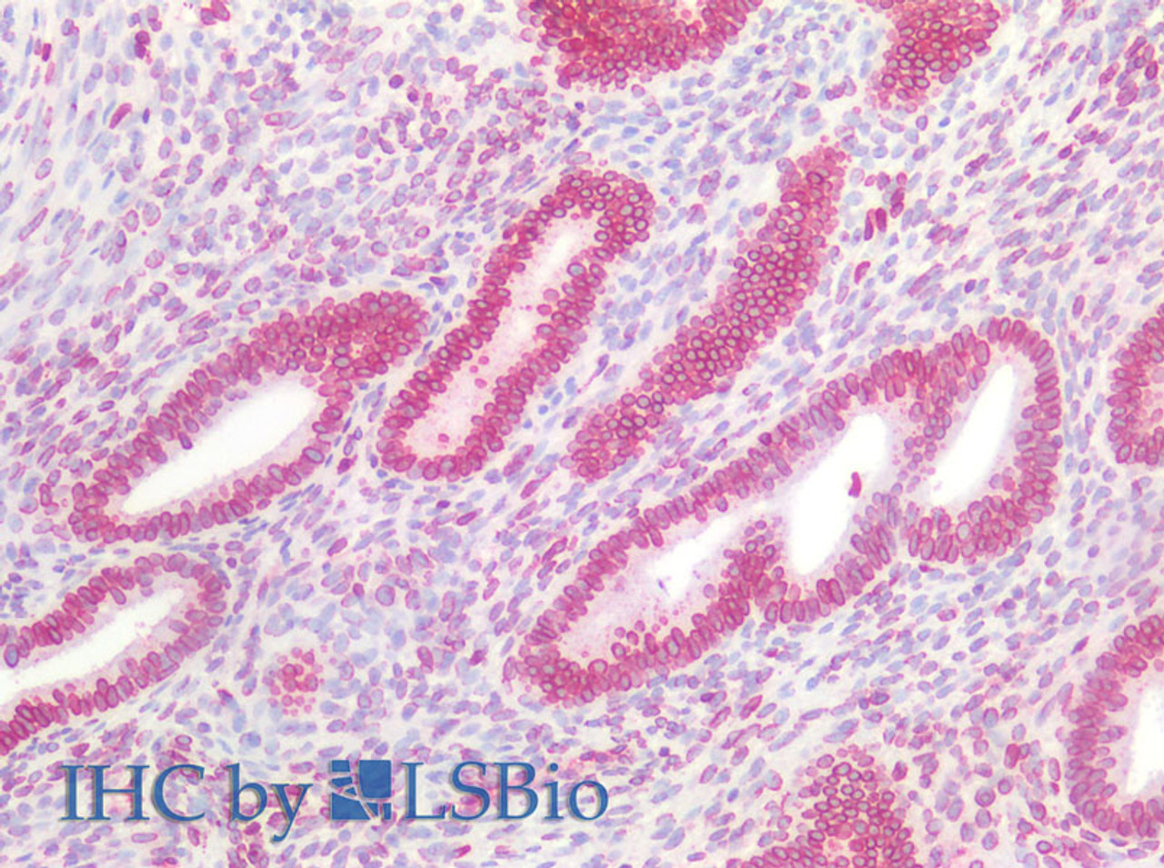 Immunohistochemistry of paraffin-embedded Human uterus using Lamin B1 Polyclonal Antibody at dilution of 1:100(Elabscience® Product Detected by Lifespan).