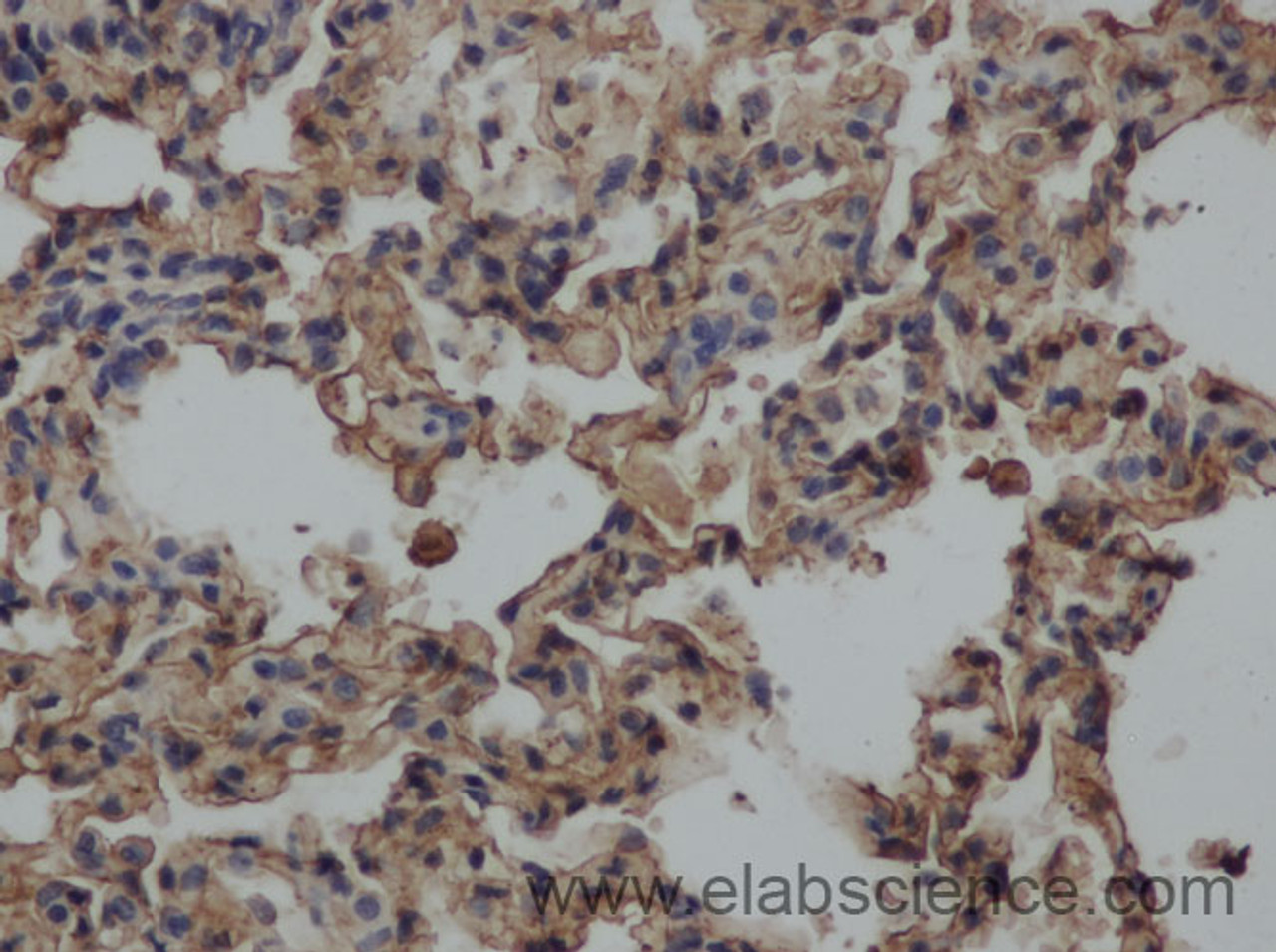 Immunohistochemistry of paraffin-embedded Rat lung using CRP Polyclonal Antibody at dilution of 1:50