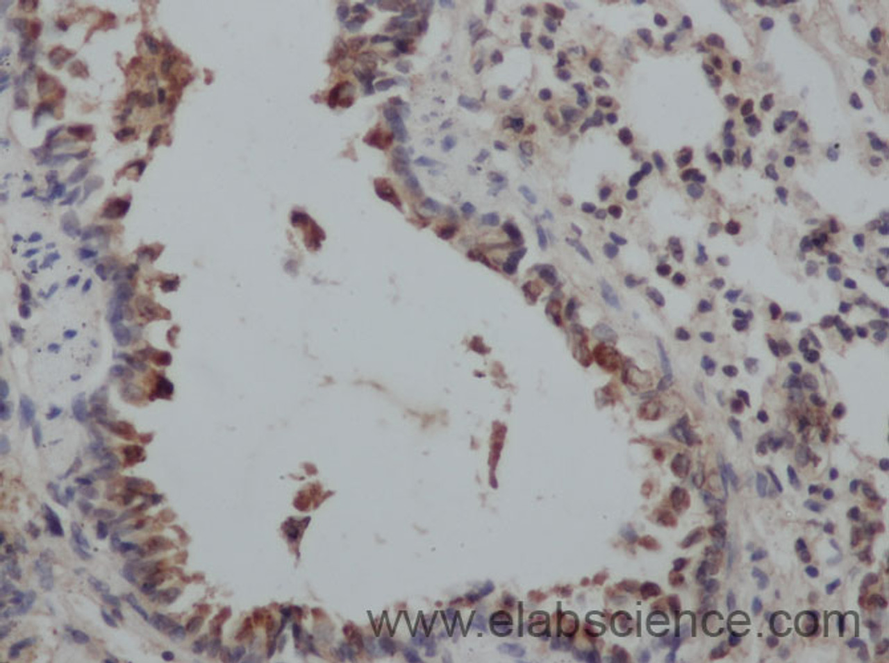 Immunohistochemistry of paraffin-embedded Rat lung using ADIPOQ Polyclonal Antibody at dilution of 1:50