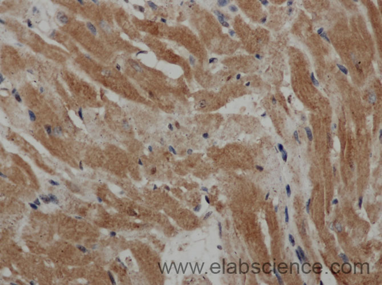 Immunohistochemistry of paraffin-embedded Mouse heart using HSP70 Polyclonal Antibody at dilution of 1:50