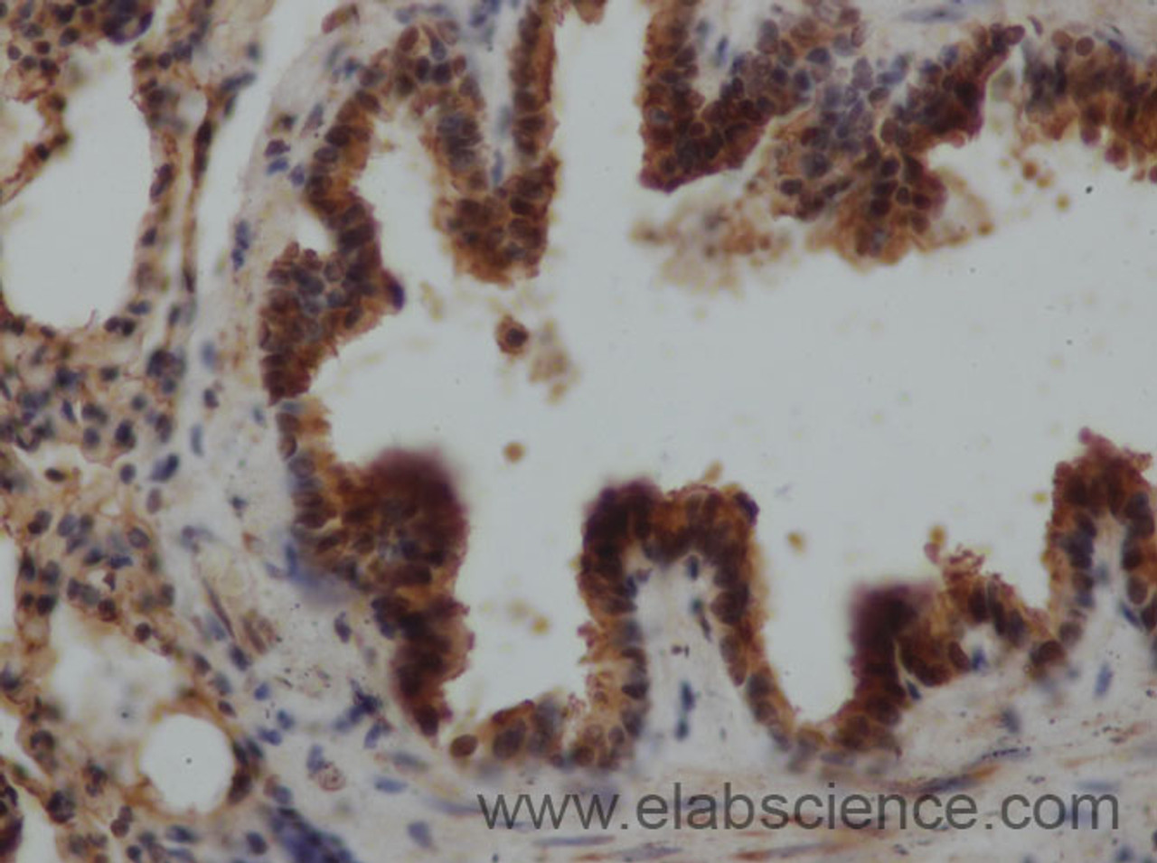 Immunohistochemistry of paraffin-embedded Rat lung using EPO Polyclonal Antibody at dilution of 1:50