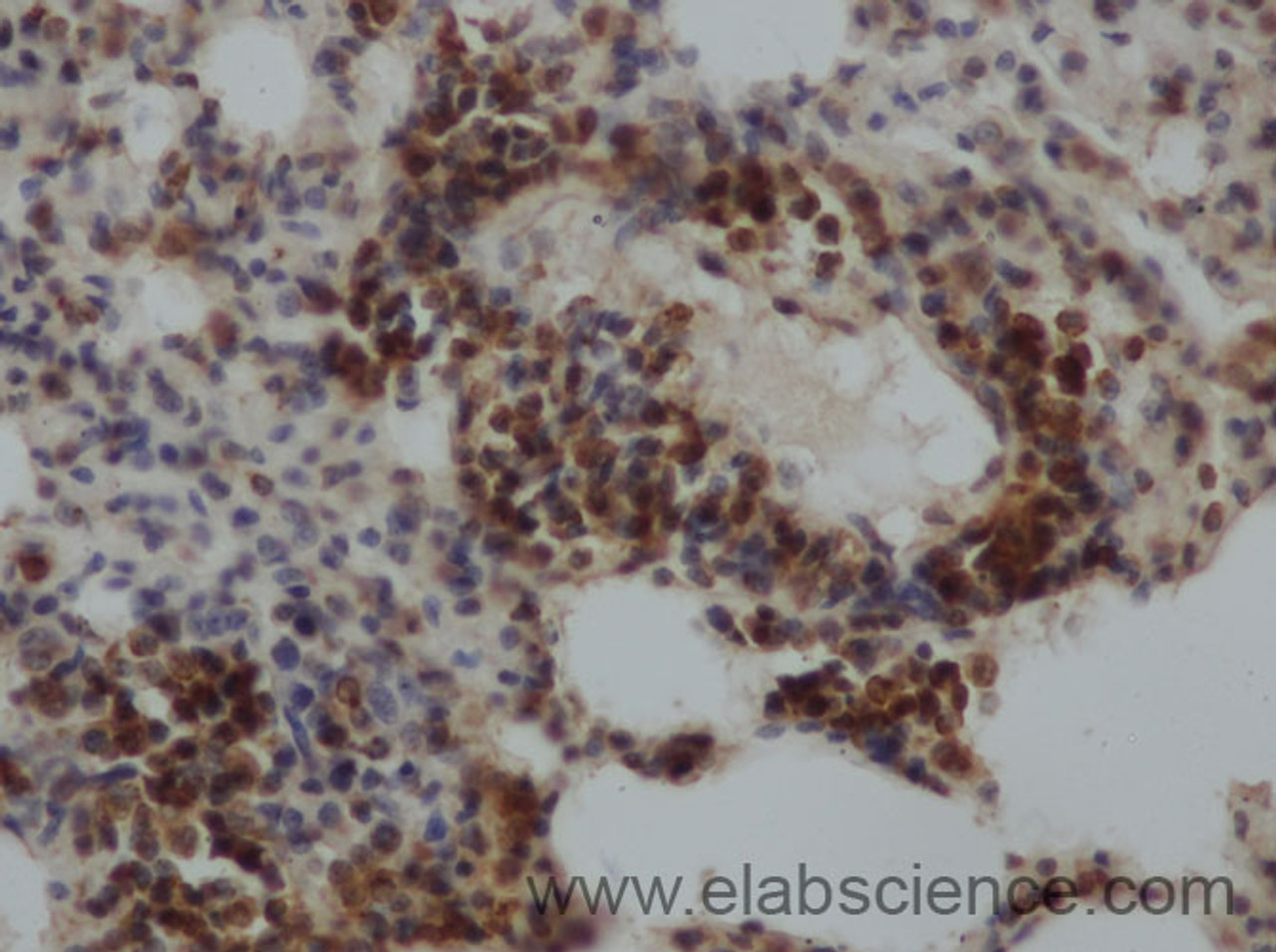 Immunohistochemistry of paraffin-embedded Rat lung using TSHB Polyclonal Antibody at dilution of 1:50