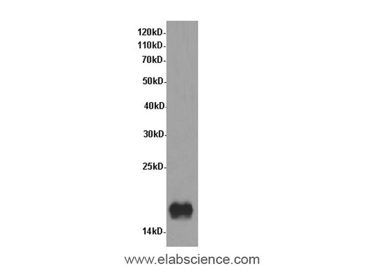 Western Blot analysis of Rat brain tissue using Cst3 Polyclonal Antibody at dilution of 1:600