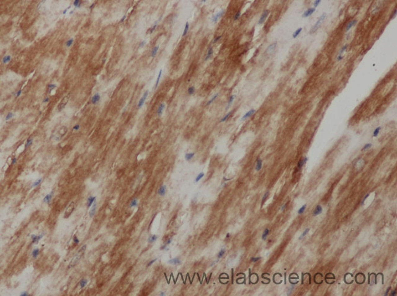 Immunohistochemistry of paraffin-embedded Mouse heart using beta Amyloid Polyclonal Antibody at dilution of 1:50
