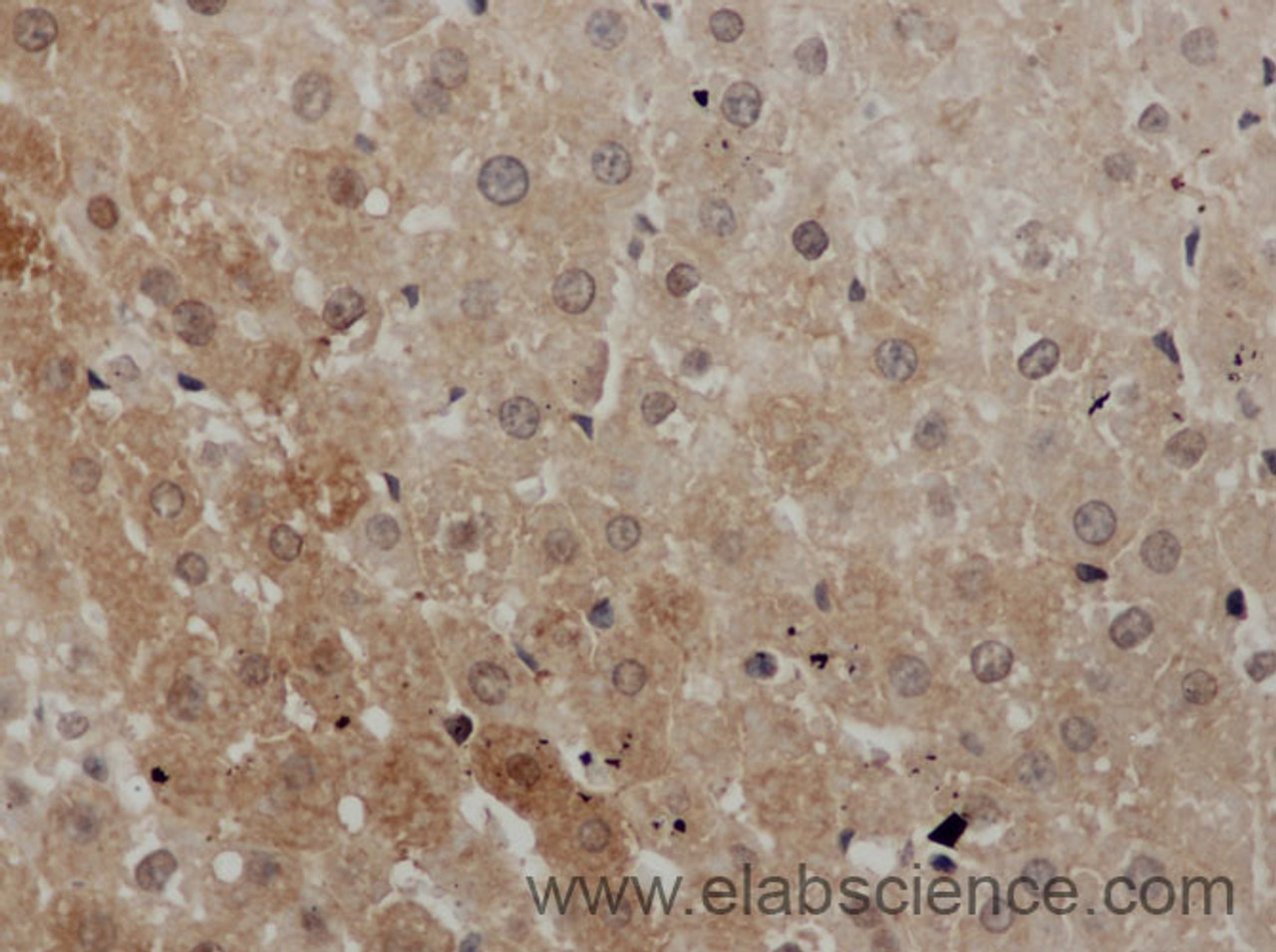 Immunohistochemistry of paraffin-embedded Mouse liver using IGF1 Polyclonal Antibody at dilution of 1:50