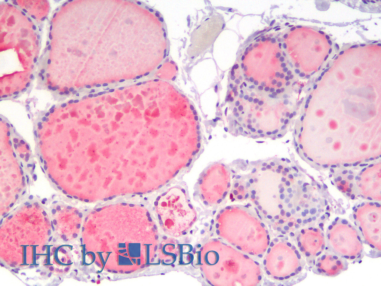 Immunohistochemistry analysis of paraffin-embedded Human Thyroid using IGF1 Polyclonal Antibody(Elabscience® Product Detected by Lifespan).