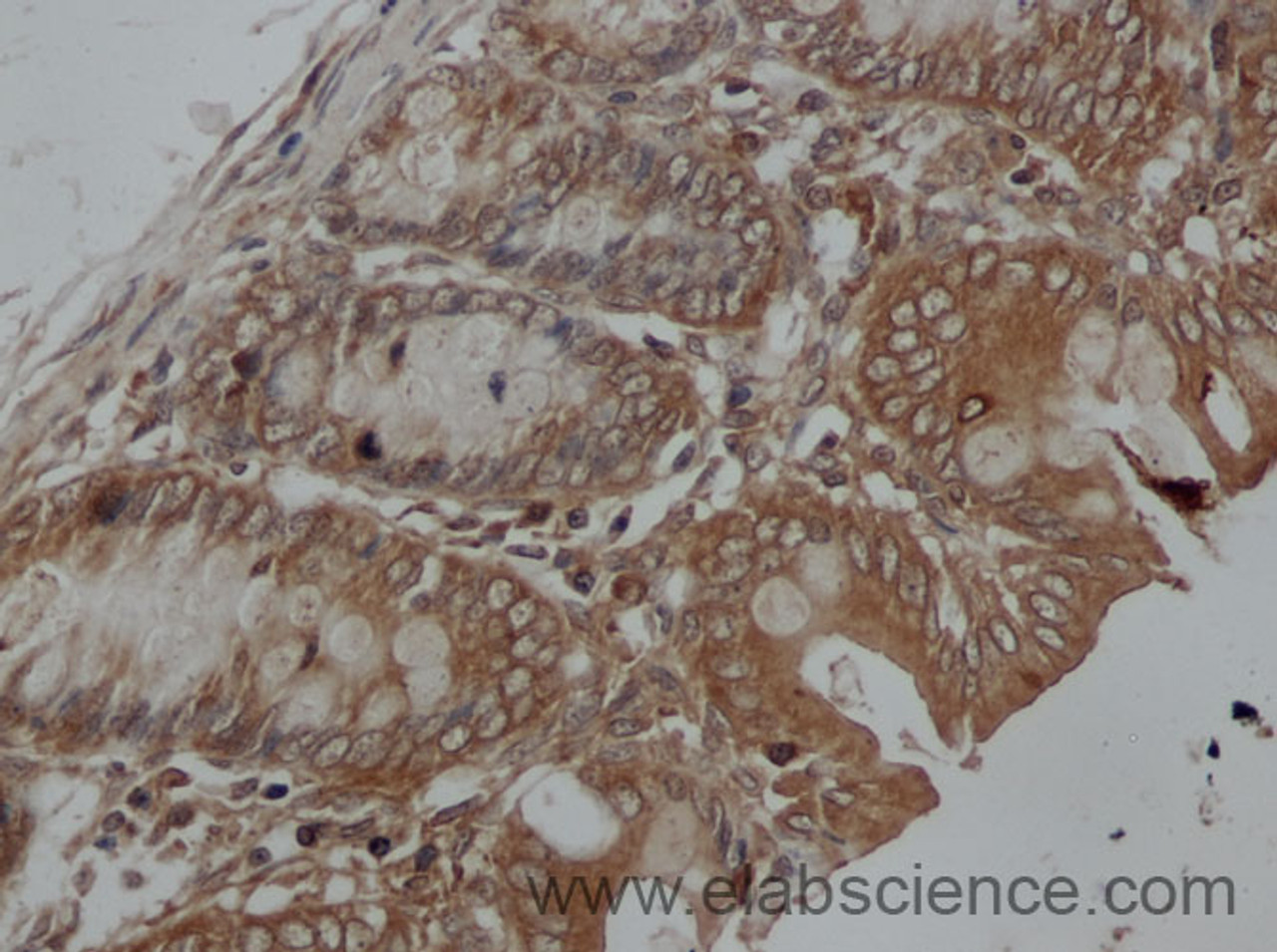 Immunohistochemistry of paraffin-embedded Rat colon using IFNB1 Polyclonal Antibody at dilution of 1:50