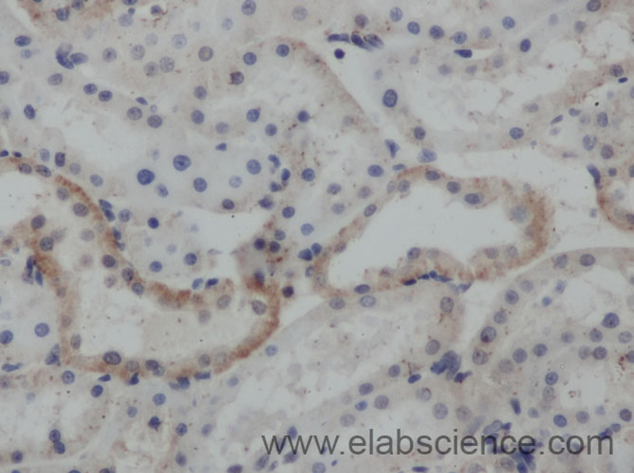 Immunohistochemistry of paraffin-embedded Rat kidney using LUM Polyclonal Antibody at dilution of 1:50