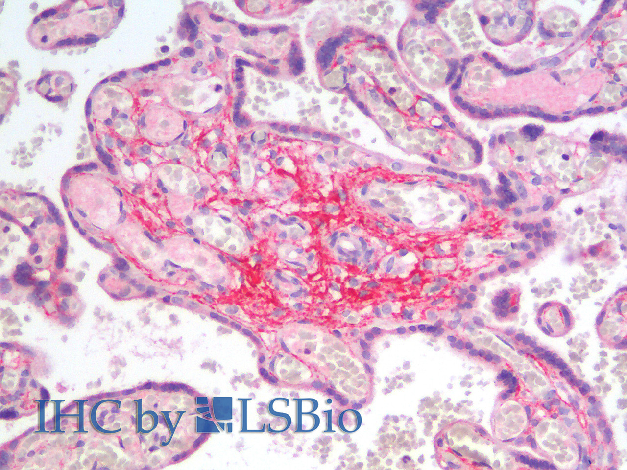 Immunohistochemistry analysis of paraffin-embedded Human Placenta using LUM Polyclonal Antibody(Elabscience® Product Detected by Lifespan).