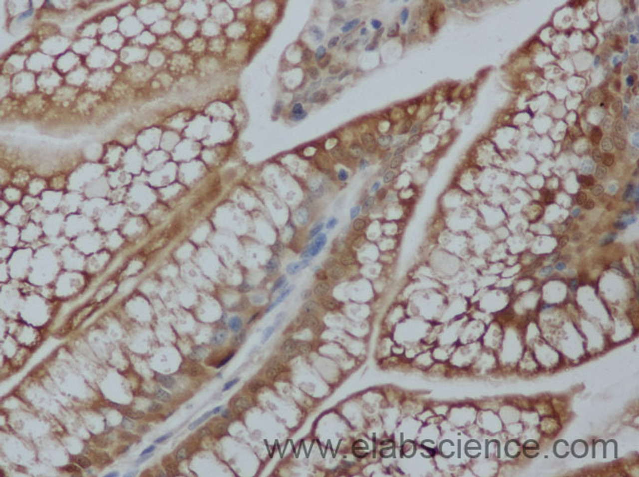 Immunohistochemistry of paraffin-embedded Mouse ileum using FABP2 Polyclonal Antibody at dilution of 1:50