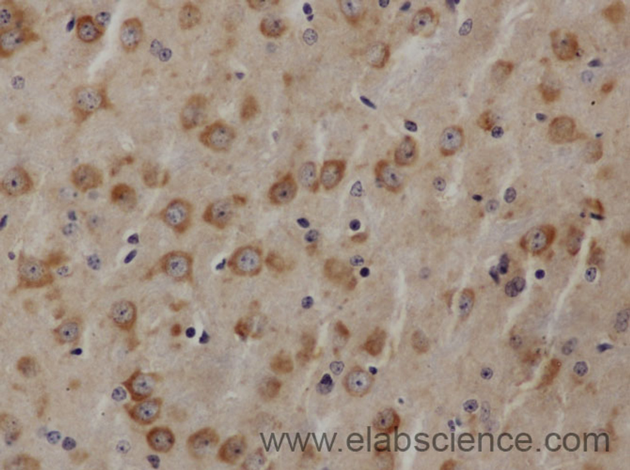 Immunohistochemistry of paraffin-embedded Mouse brain using AKT1 Polyclonal Antibody at dilution of 1:50