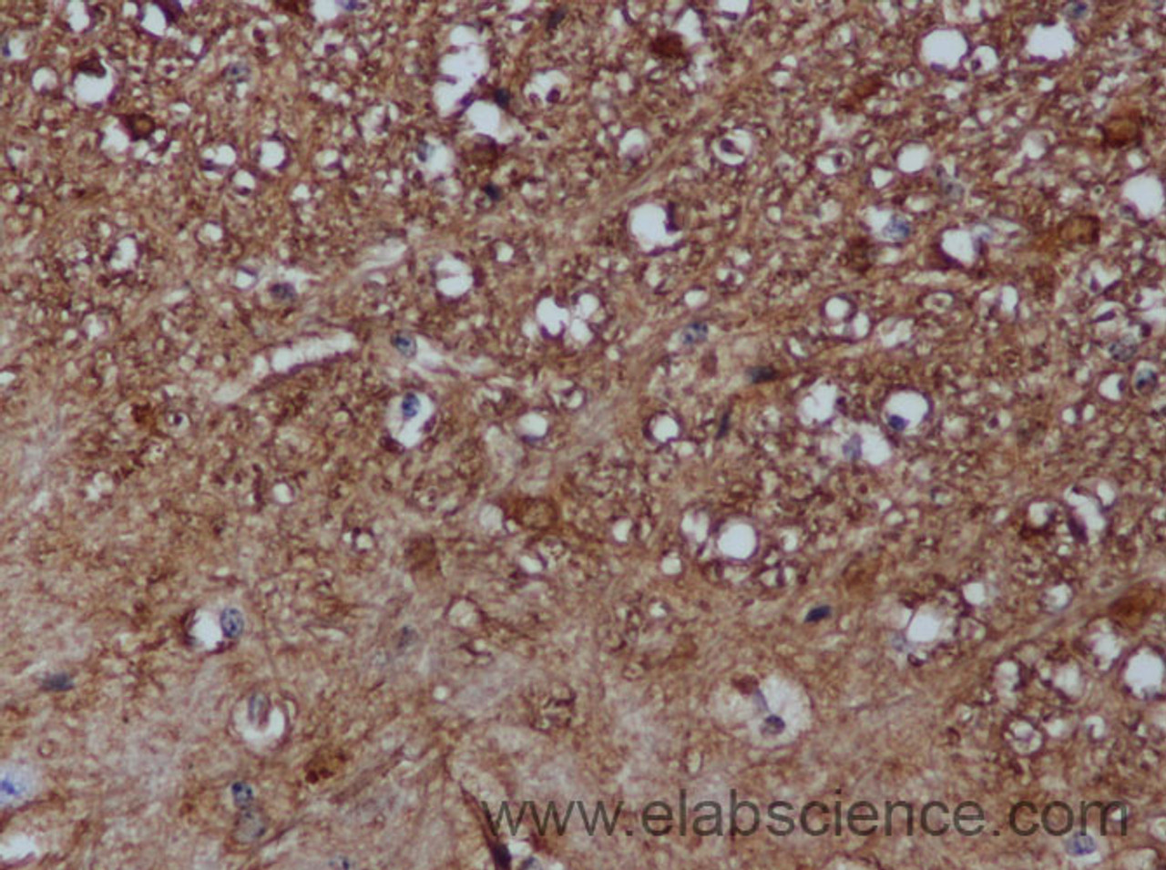 Immunohistochemistry of paraffin-embedded Mouse spinal-cord using S100B Polyclonal Antibody at dilution of 1:50