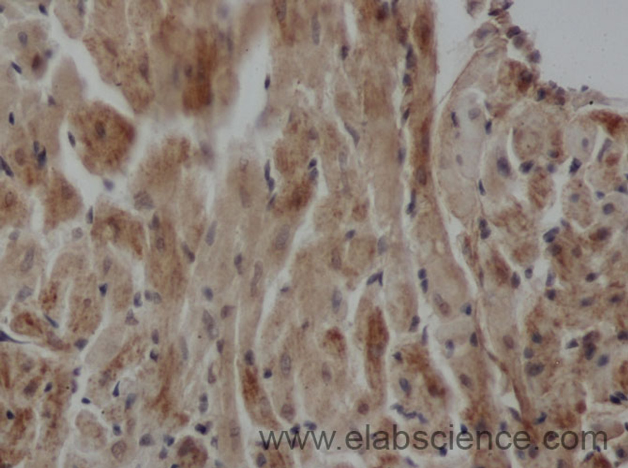 Immunohistochemistry of paraffin-embedded Rat heart using ARF6 Polyclonal Antibody at dilution of 1:50