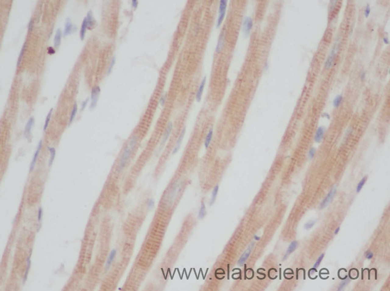 Immunohistochemistry of paraffin-embedded Mouse heart using CD207 Polyclonal Antibody at dilution of 1:50