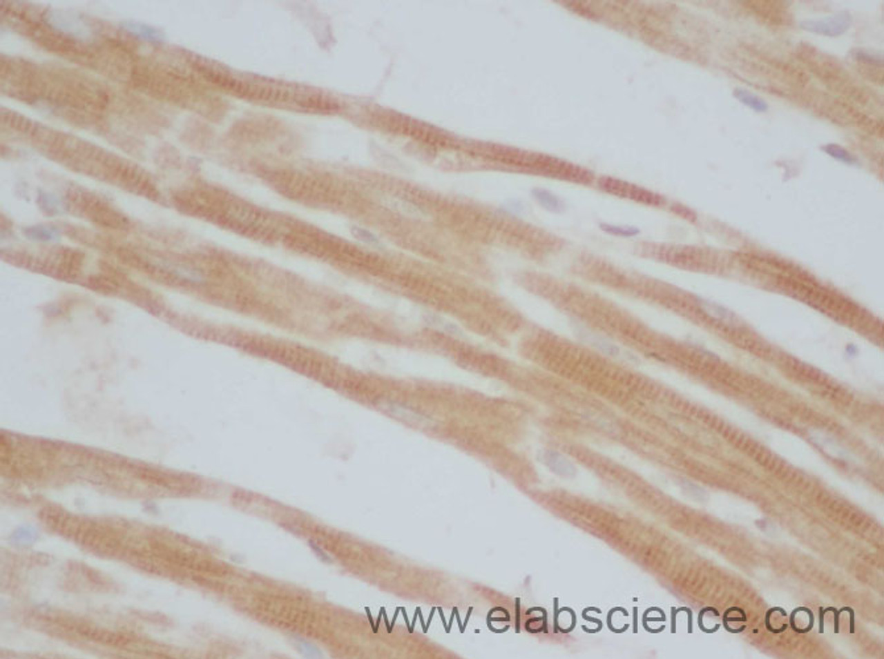 Immunohistochemistry of paraffin-embedded Mouse heart using UCP3 Polyclonal Antibody at dilution of 1:50