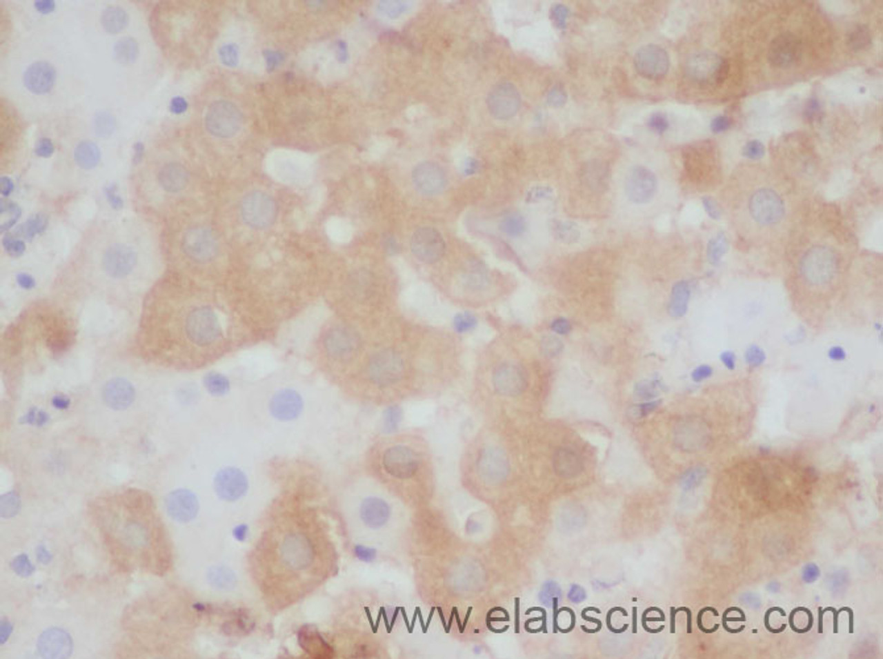 Immunohistochemistry of paraffin-embedded Rat liver using STAT1 Polyclonal Antibody at dilution of 1:50