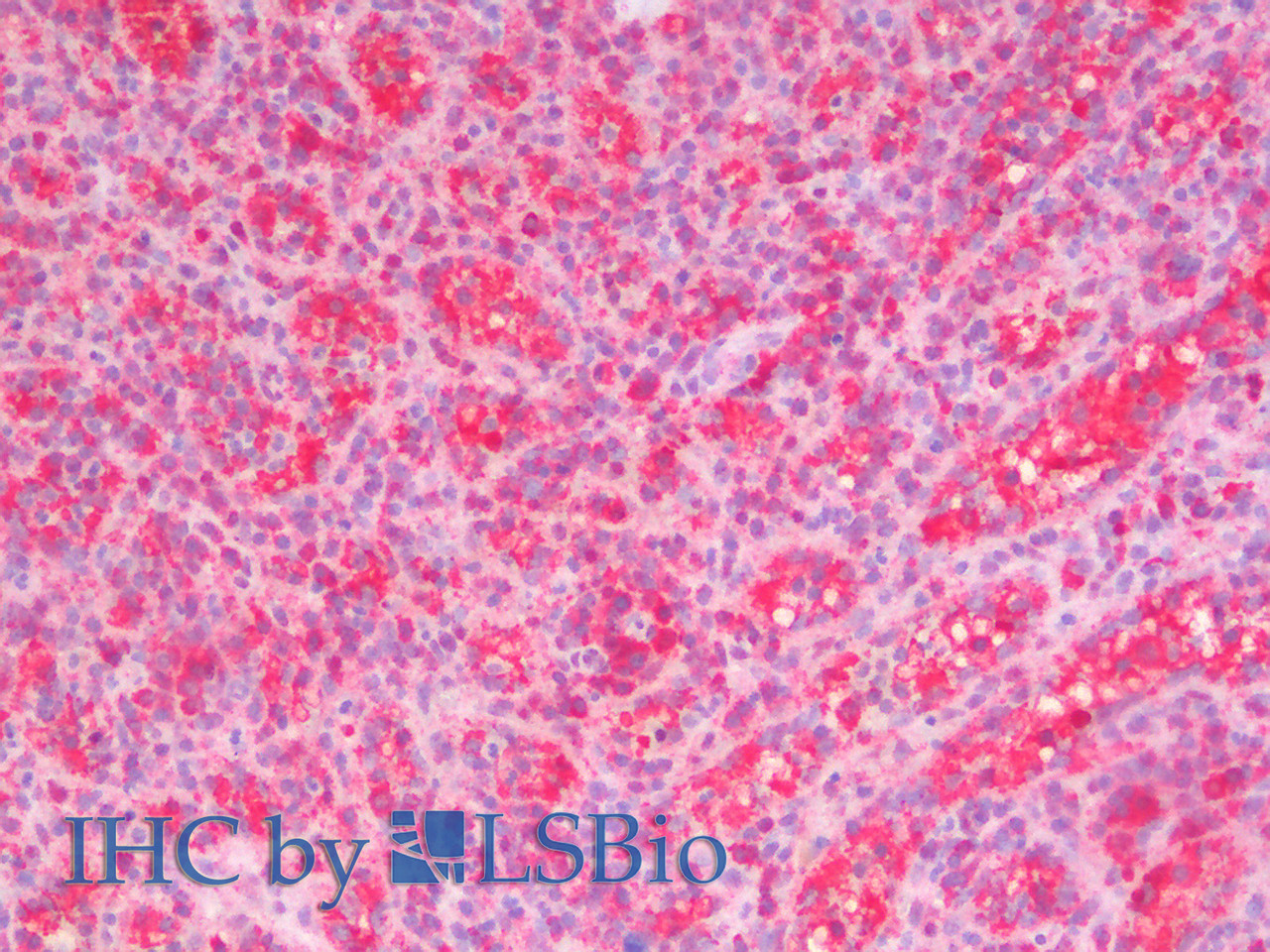 Immunohistochemistry analysis of paraffin-embedded Human Spleen using STAT1 Polyclonal Antibody(Elabscience® Product Detected by Lifespan).