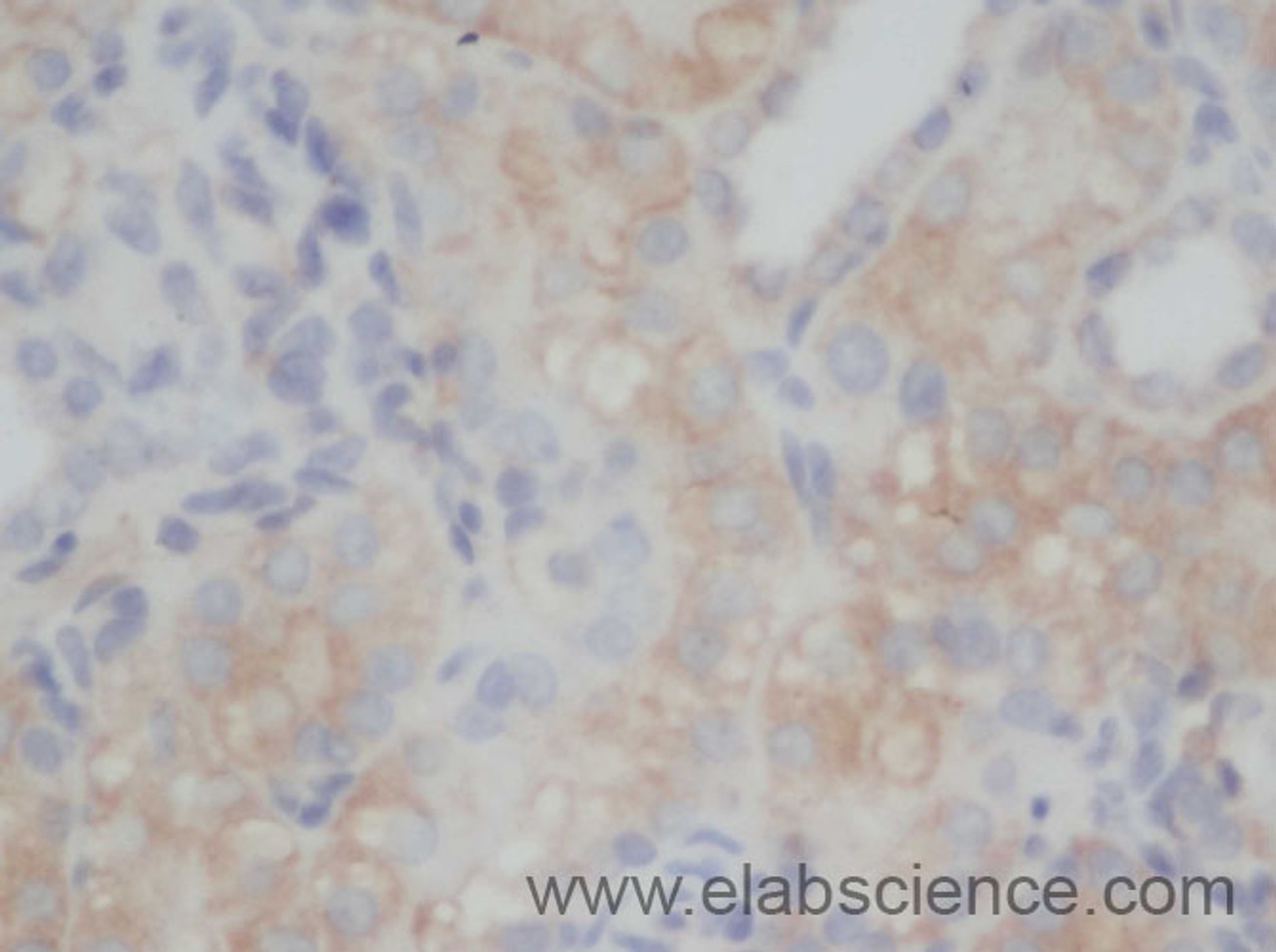 Immunohistochemistry of paraffin-embedded Rat kidney using CD70 Polyclonal Antibody at dilution of 1:50