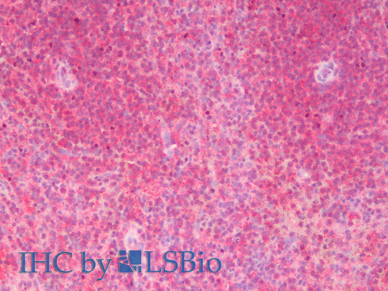 Immunohistochemistry analysis of paraffin-embedded Human Spleen using CD70 Polyclonal Antibody(Elabscience® Product Detected by Lifespan).