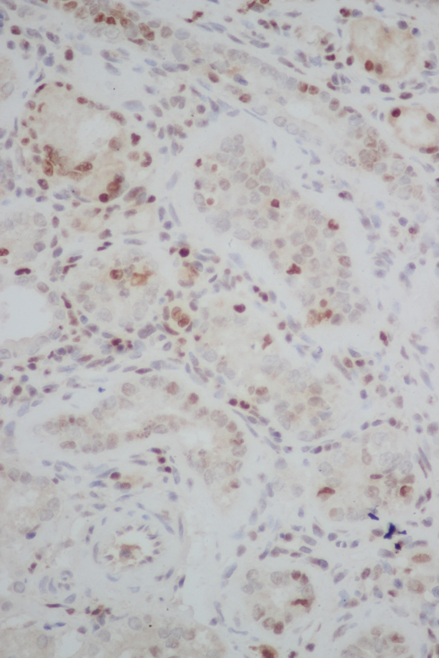 Immunohistochemistry of paraffin-embedded Rat kidney using PCNA Polyclonal Antibody at dilution of 1:50