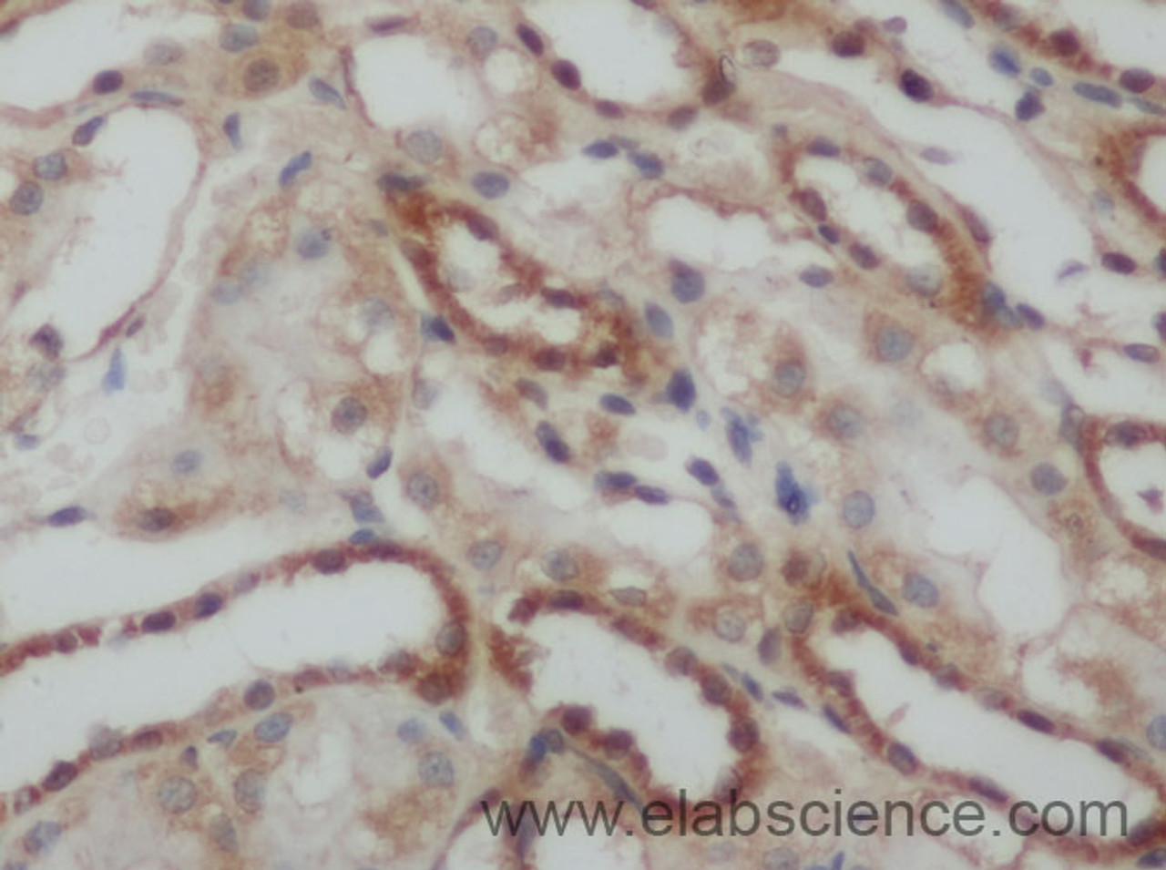 Immunohistochemistry of paraffin-embedded Rat kidney using PBK Polyclonal Antibody at dilution of 1:50