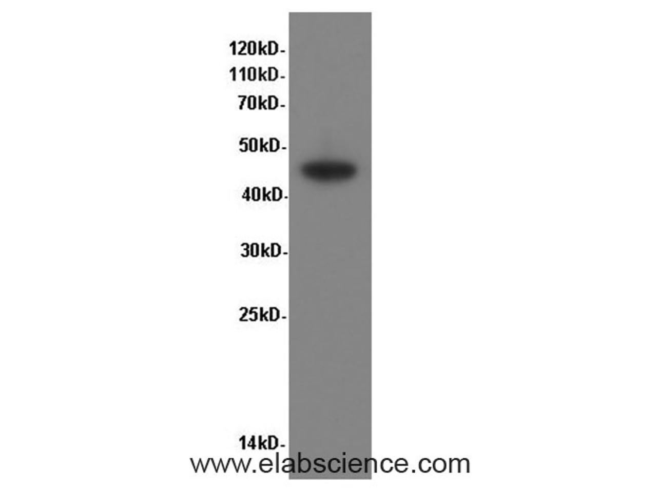 Western Blot analysis of Caco-2 cells using CK-20 Polyclonal Antibody at dilution of 1:600