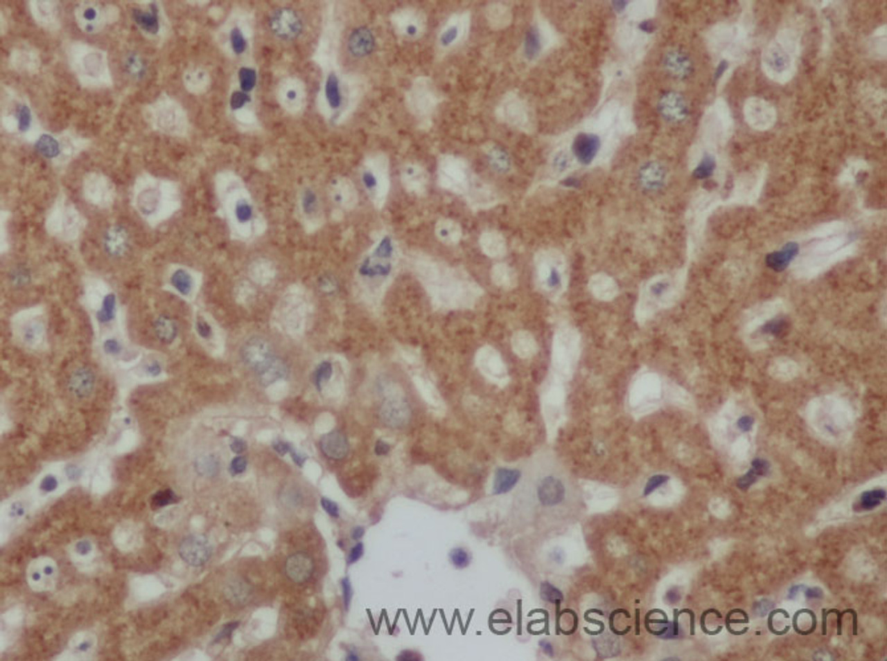 Immunohistochemistry of paraffin-embedded Mouse liver using CK-20 Polyclonal Antibody at dilution of 1:50