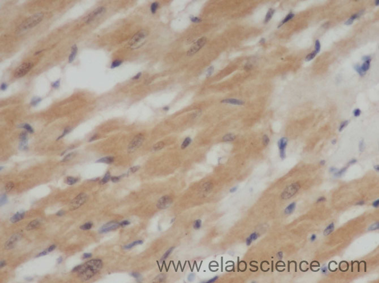 Immunohistochemistry of paraffin-embedded Rat heart using IL6 Polyclonal Antibody at dilution of 1:50