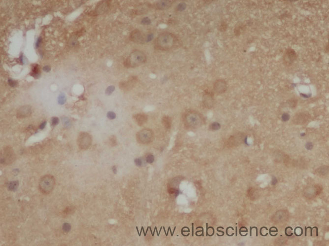 Immunohistochemistry of paraffin-embedded Mouse brain using IL6 Polyclonal Antibody at dilution of 1:50