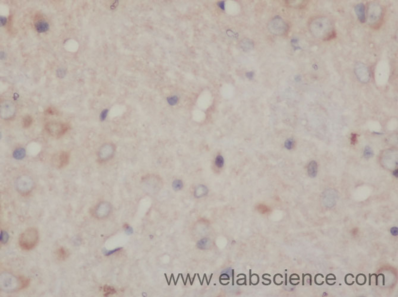 Immunohistochemistry of paraffin-embedded Rat brain using SDHA Polyclonal Antibody at dilution of 1:50