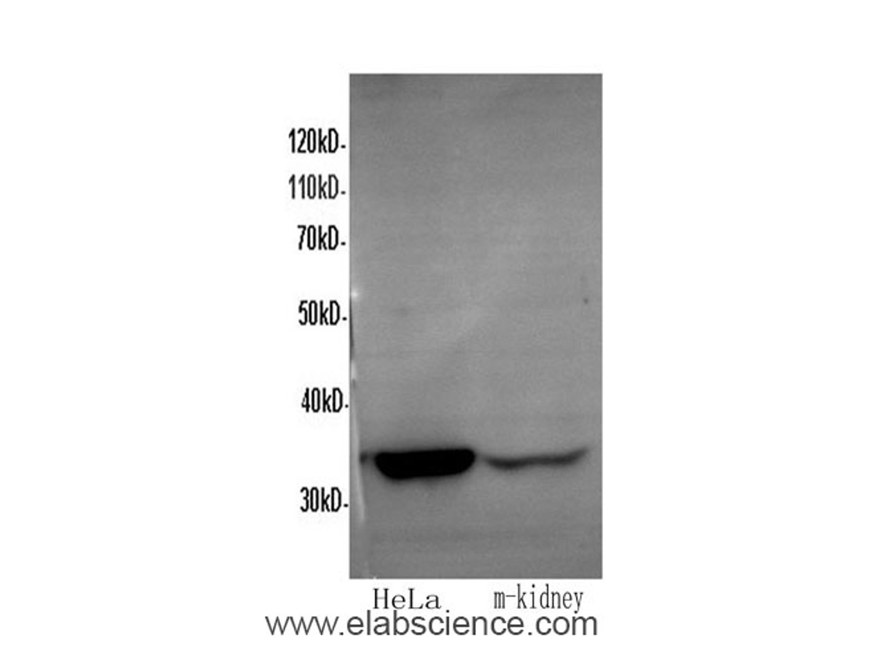 Western Blot analysis of HeLa and Mouse kidney using ANXA5 Polyclonal Antibody at dilution of 1:600