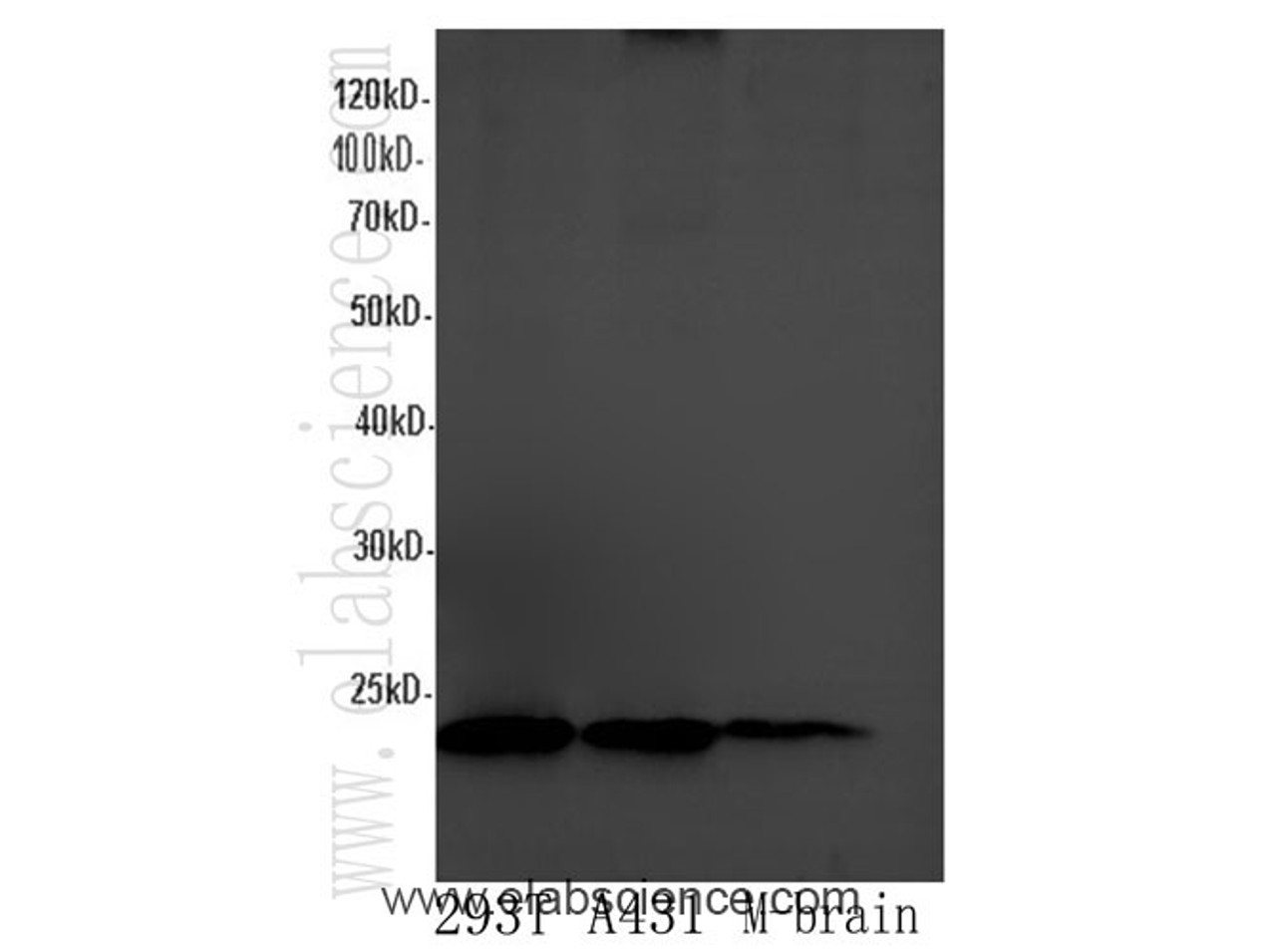 Western Blot analysis of 293T cells, Mouse brain and A431 cells using EEF1E1 Polyclonal Antibody at dilution of 1:600