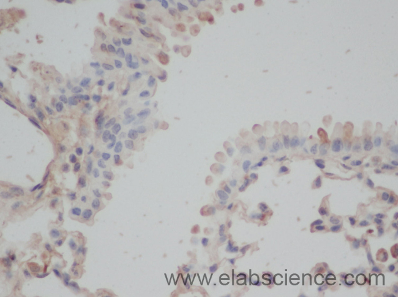 Immunohistochemistry of paraffin-embedded Mouse lung using EEF1E1 Polyclonal Antibody at dilution of 1:50