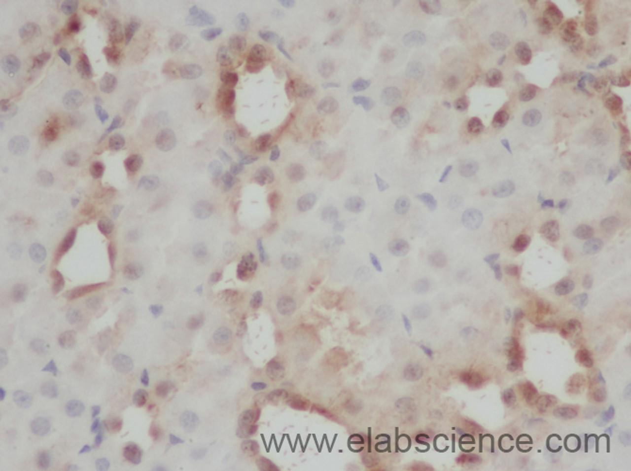 Immunohistochemistry of paraffin-embedded Rat kidney using PARP3 Polyclonal Antibody at dilution of 1:50