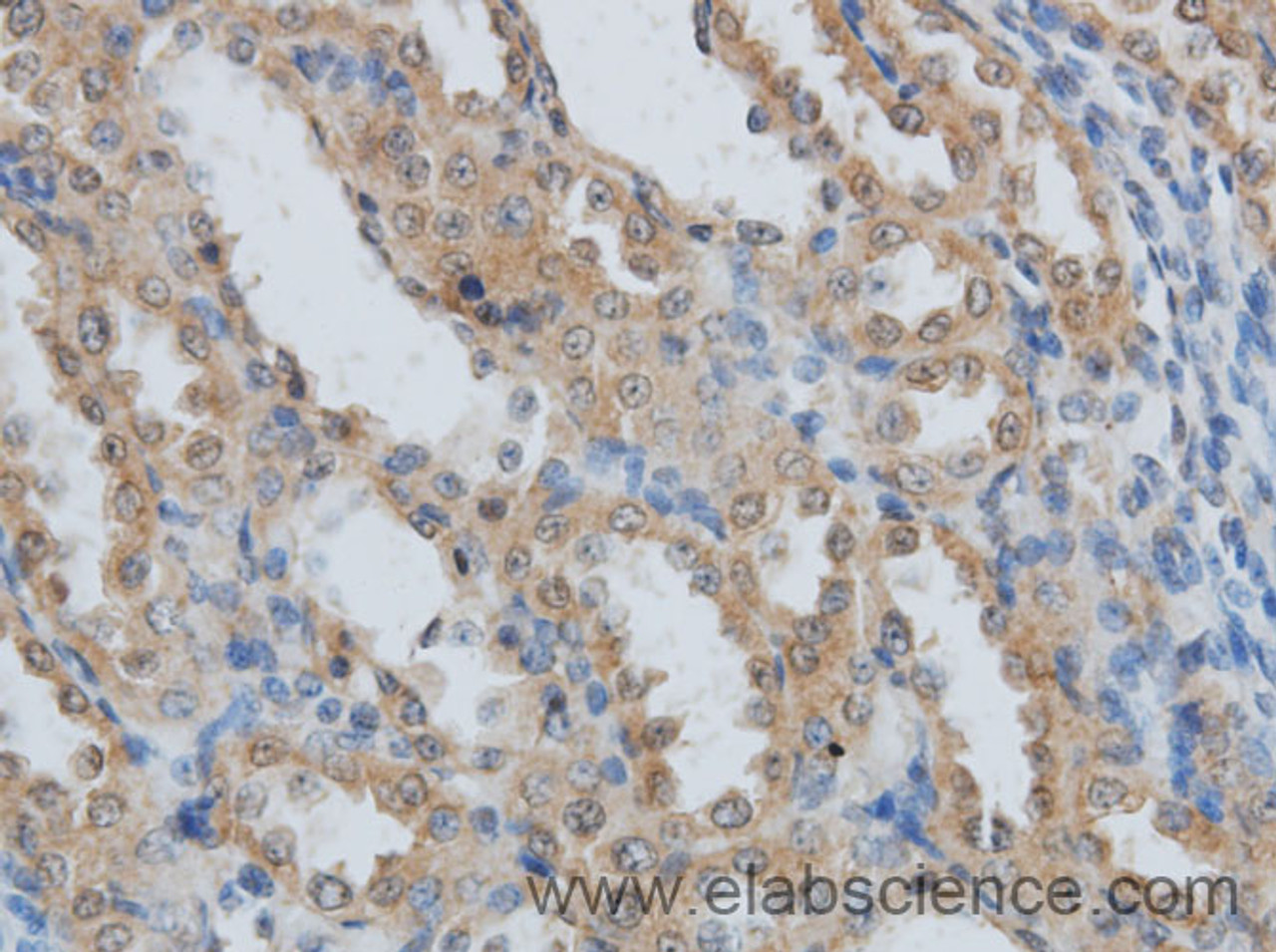 Immunohistochemistry of paraffin-embedded Rat kidney using IRF3 Polyclonal Antibody at dilution of 1:50