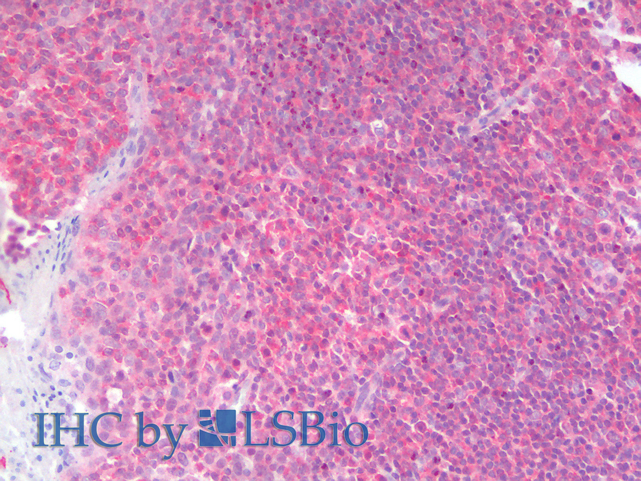 Immunohistochemistry analysis of paraffin-embedded Human Tonsil using IRF3 Polyclonal Antibody(Elabscience® Product Detected by Lifespan).