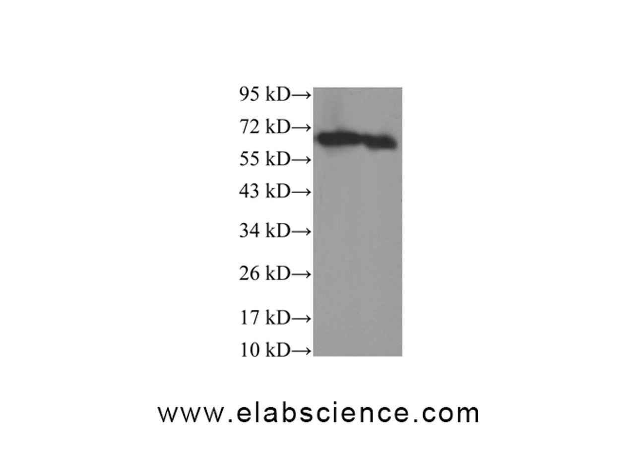 Western Blot analysis of 293T and Rat liver using STK4 Polyclonal Antibody at dilution of 1:600