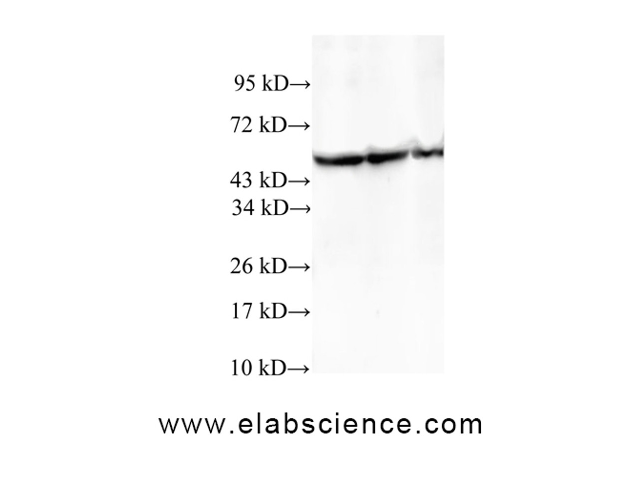 Western Blot analysis of HeLa, A549 and 293T cells using TCP1 Polyclonal Antibody at dilution of 1:600