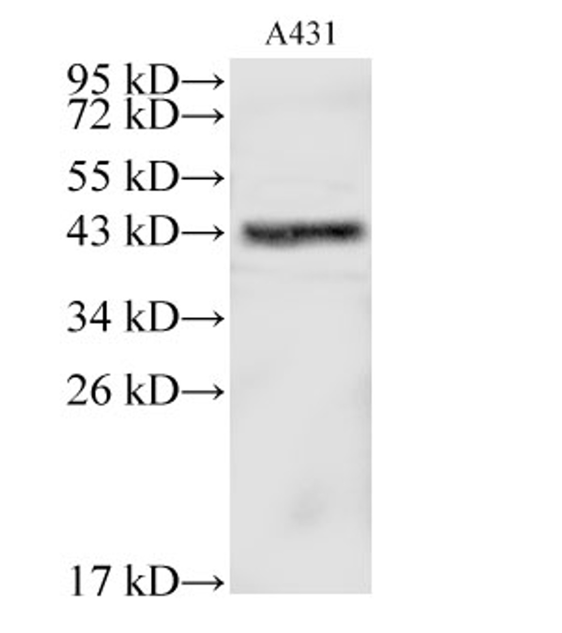 Western Blot analysis of A431 cells using MAPK13 Polyclonal Antibody at dilution of 1:500