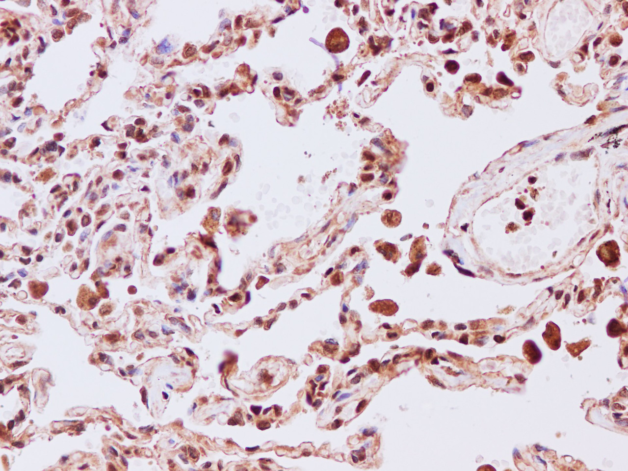 Immunohistochemistry of paraffin-embedded Human lung using MAPK13 Polyclonal Antibody at dilution of 1:200