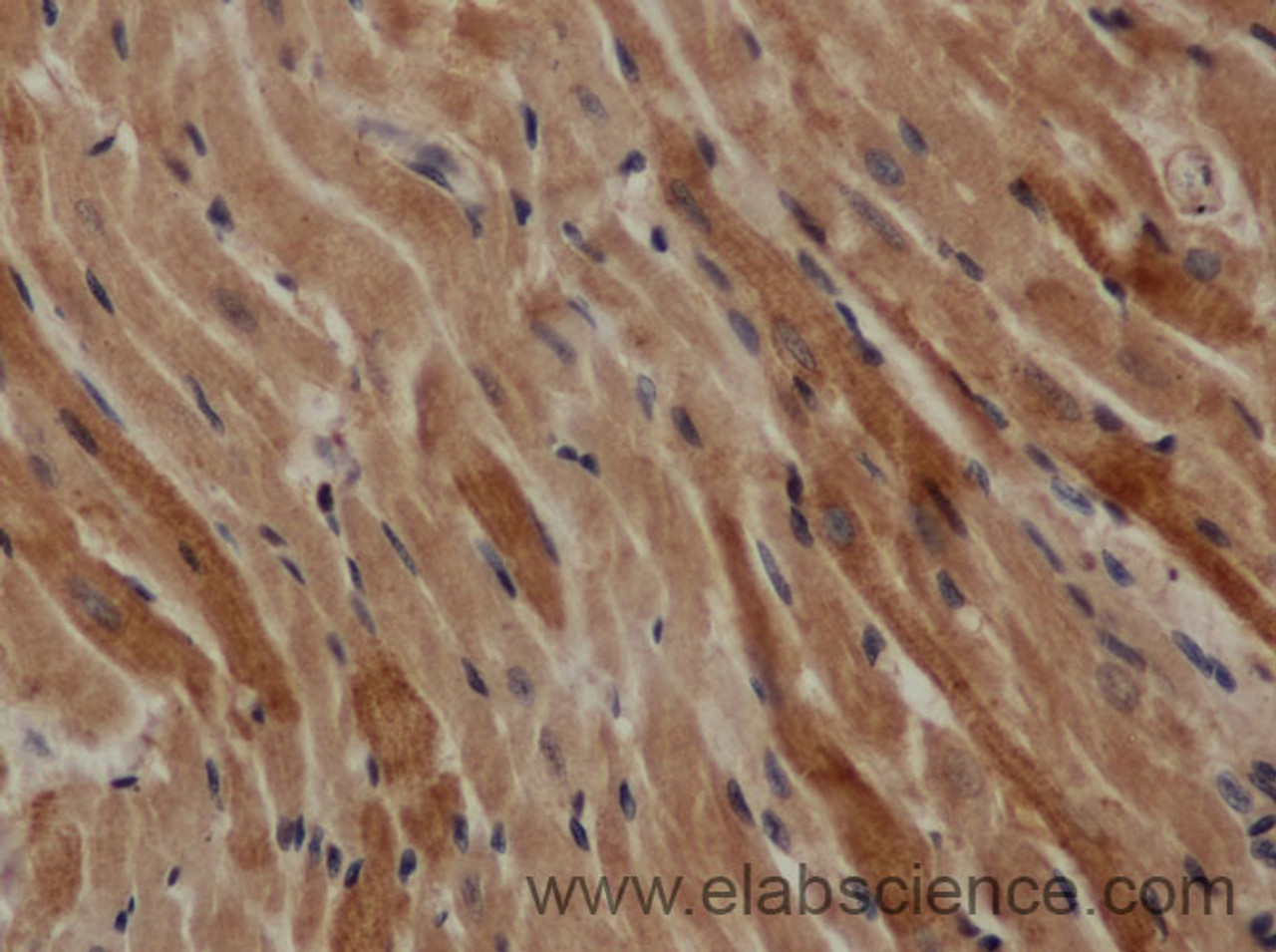 Immunohistochemistry of paraffin-embedded Mouse heart using TGFB1 Polyclonal Antibody at dilution of 1:50