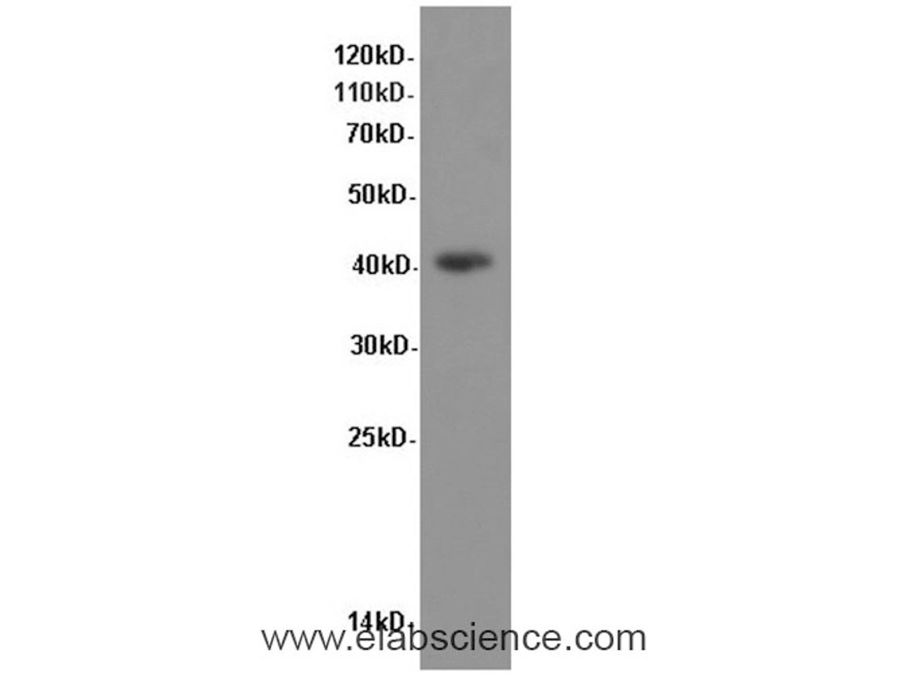 Western Blot analysis of NIH/3T3 cells using P38 Polyclonal Antibody at dilution of 1:600